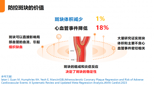 非药物干预：NSKSD纳豆激酶在血管斑块管理中的应用